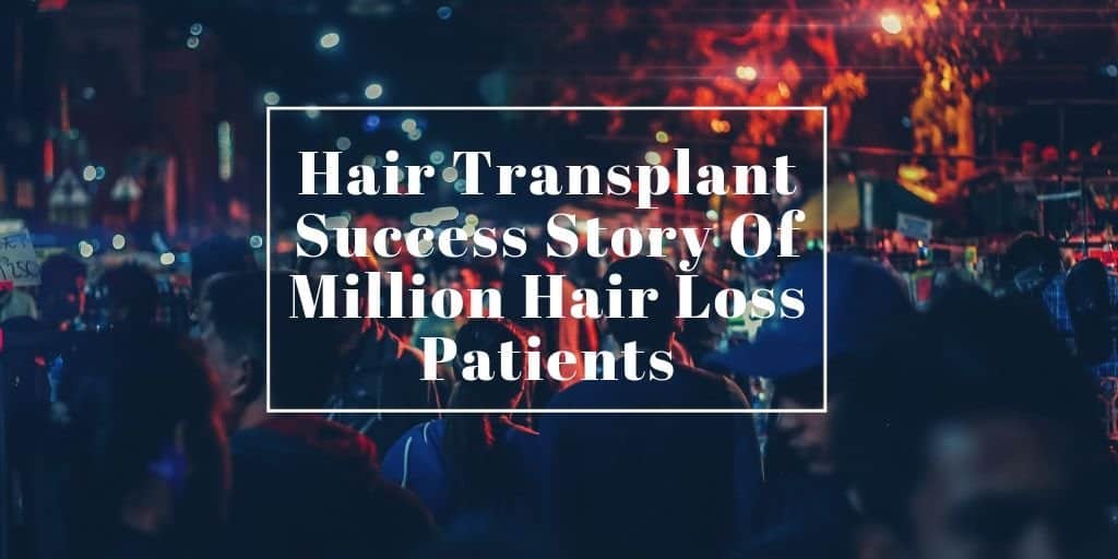Hair Transplant Success Story Of Million Hair Loss Patients