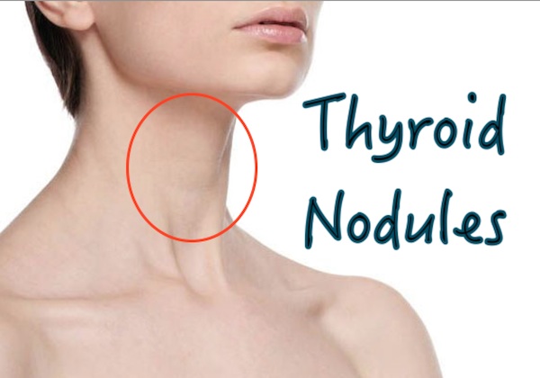 Thyroid-problems